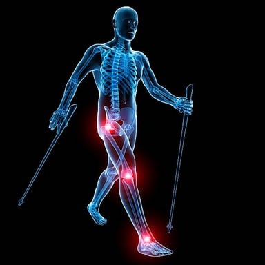 Arthrose : quelles précautions prendre pour randonner ?